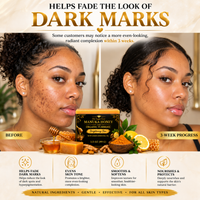 Organic Turmeric & Manuka Honey Brightening Soap
